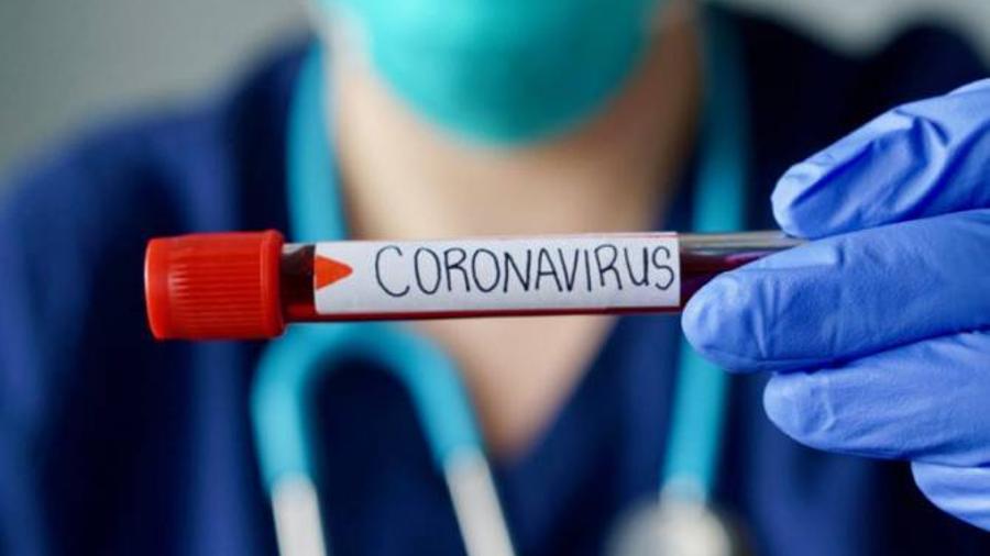 Ադրբեջանում կորոնավիրուսի 29 նոր դեպք կա, հիվանդներից մեկը մահացել է․ Interfax.az
 |panarmenian.net|