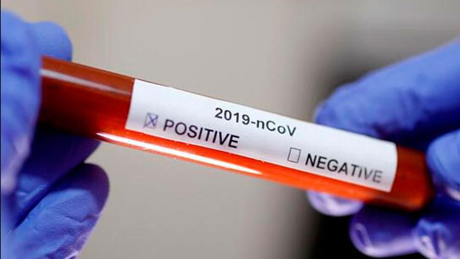 Արցախի Հանրապետության ևս 27 քաղաքացու մոտ կորոնավիրուսի թեստավորման արդյունքները բացասական են