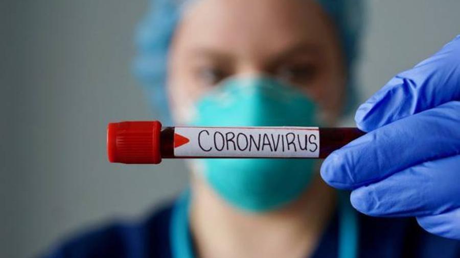 Արցախում հաստատվել է կորոնավիրուսի  4 նոր դեպք