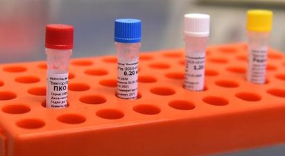 ԱՆ-ն հրապարակել է լաբորատորիաների ցանկը, որտեղ իրականացվում են կորոնավիրուսային հիվանդության նկատմամբ լաբորատոր հետազոտություններ
