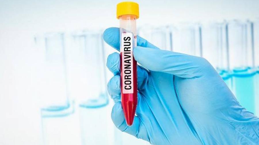 Մոլեկուլային կենսաբանության ինստիտուտն արդեն 47 հազարից ավելի թեստ է մատակարարել |armenpress.am|