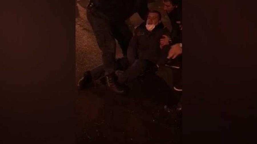 Առողջապահության նախարարի և ոստիկանապետի տեղակալներն այցելել են քաղաքացիների հետ բախման ընթացքում ոտքը կոտրած ոստիկանին
