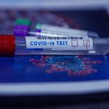 Երեկ կատարվել է 2754 թեստավորում, որից հաստատվել է կորոնավիրուսային հիվանդության 37 նոր դեպք: Ունենք 95 առողջացած և 4 մահվան դեպք:  [ՀՀ ԱՆ]