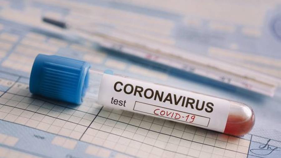 Կորոնավիրուսային հիվանդության չորս նոր դեպք է գրանցվել Արցախում
