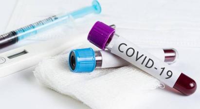COVID-19-ից ևս մեկ ծննդկան է մահացել