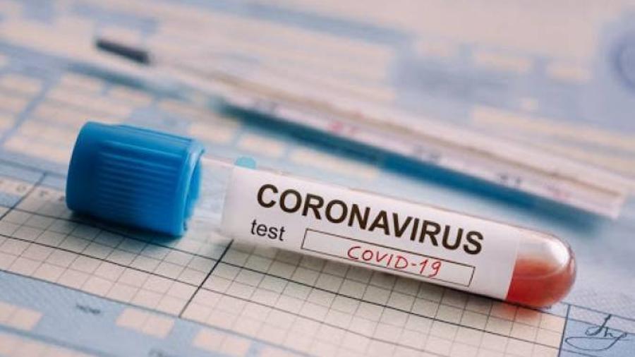 Արցախում hաստատվել է կորոնավիրուսային հիվանդության 63 նոր դեպք, մահացել է 4 քաղաքացի
