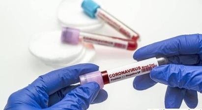 Արցախում գրանցվել է կորոնավիրուսային հիվանդության 74 նոր դեպք, հիվանդներից 5- ի վիճակը գնահատվում է ծայրահեղ ծանր