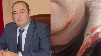 Ստեփանավանի ՔՊ-ական քաղաքապետը փորձել է դանակով կտրել իրեն դիմած քաղաքացու կոկորդը. փաստաբան
