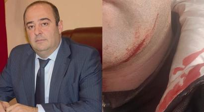 Ստեփանավանի ՔՊ-ական քաղաքապետը փորձել է դանակով կտրել իրեն դիմած քաղաքացու կոկորդը. փաստաբան
