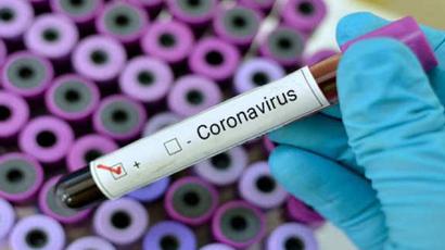 Կորոնավիրուսի նկատմամբ թեստավորում կարող է իրականացվել միայն բժշկական ցուցումներով. նախարարություն